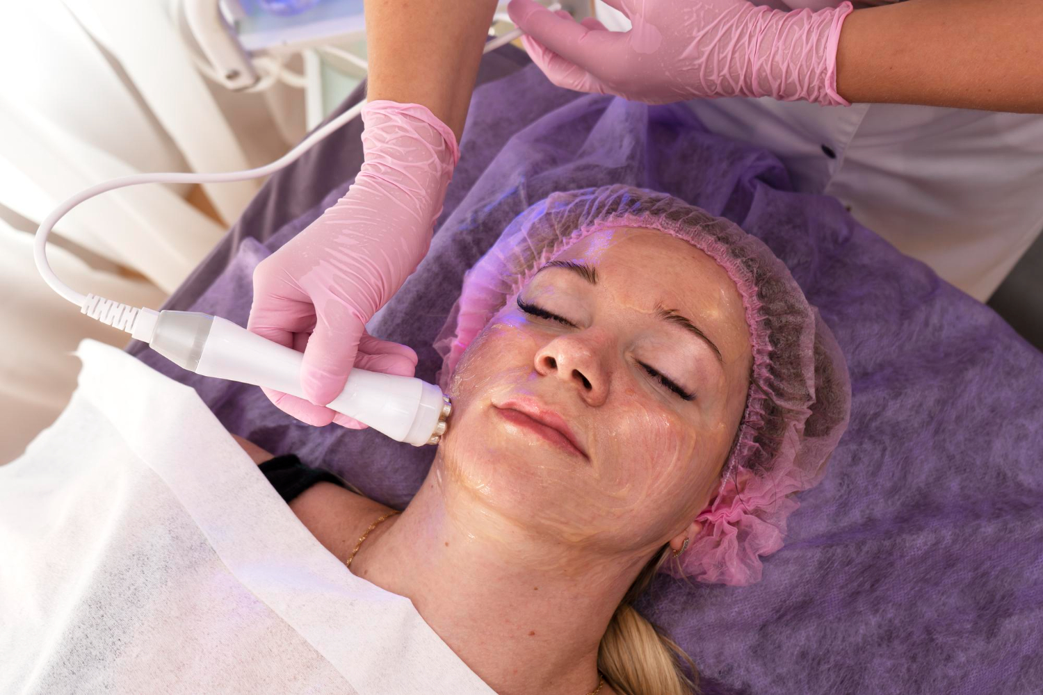 Microdermabrasion Facial Treatment