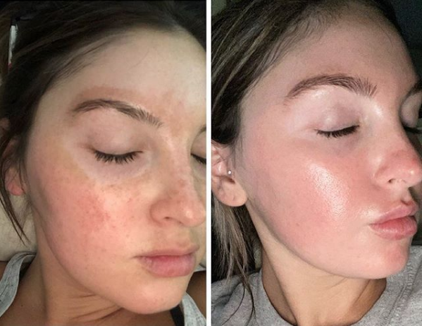 Custom Blend Facial Treatment
